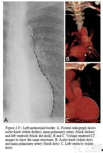 x线视频教学,透视医学影像学的奥秘之旅